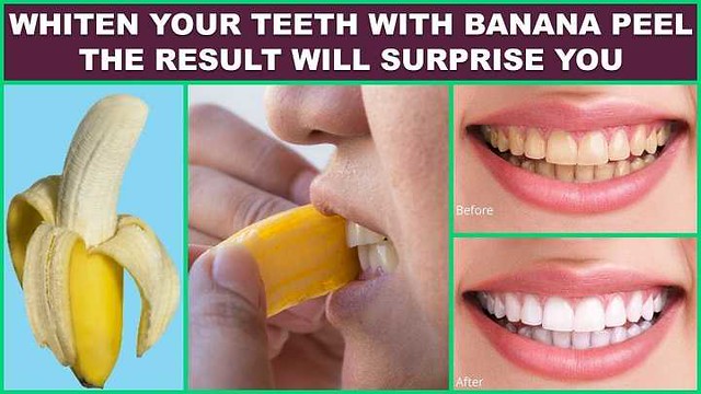 4935 10 miraculous benefits of the Banana Peels for your body 01