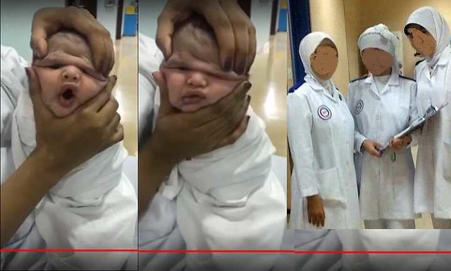 4098 Taif Hospital terminates 3 nurses for molesting a 12 hours old baby
