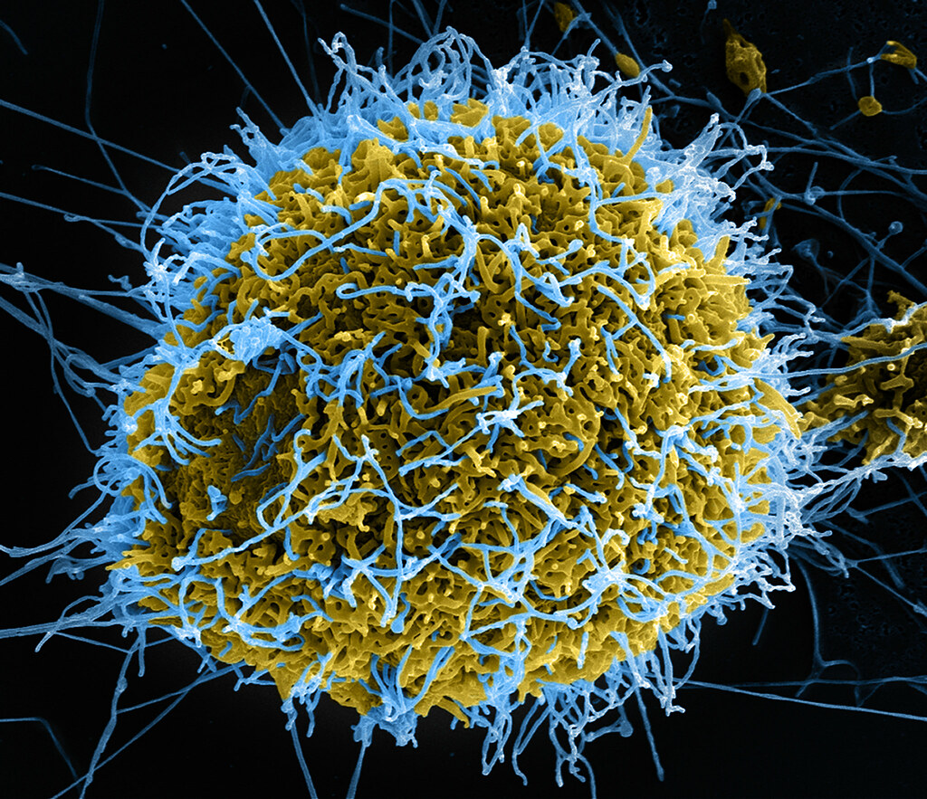 Ebola Virus Particles | Colorized scanning electron ...