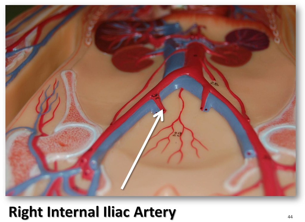 Right internal iliac artery - The Anatomy of the Arteries … | Flickr