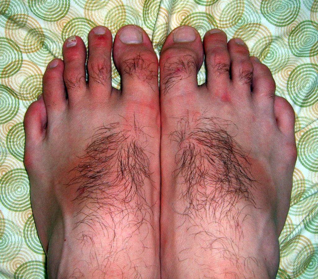 Feet tan... ok I know they're ugly.