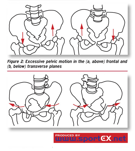 Excessive pelvic motion in the (a, above) frontal and (b, below) transverse planes