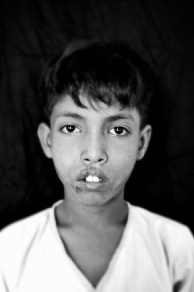 Aziz pre op | Islamic Help | Flickr