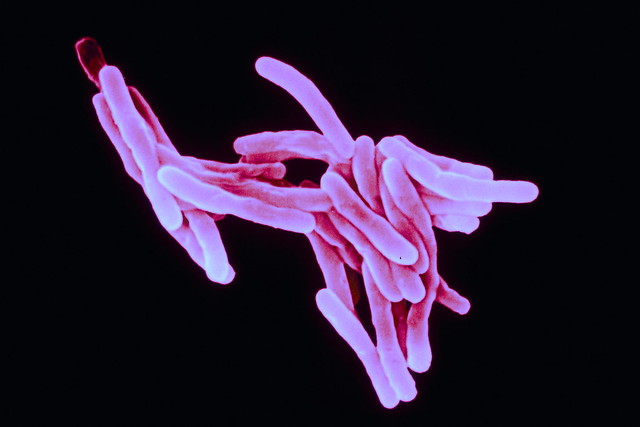 Tuberculosis (Mycobacterium tuberculosis bacillus)