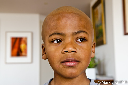My Dad Shaved My Head