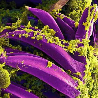 Yersinia pestis Bacteria | by NIAID
