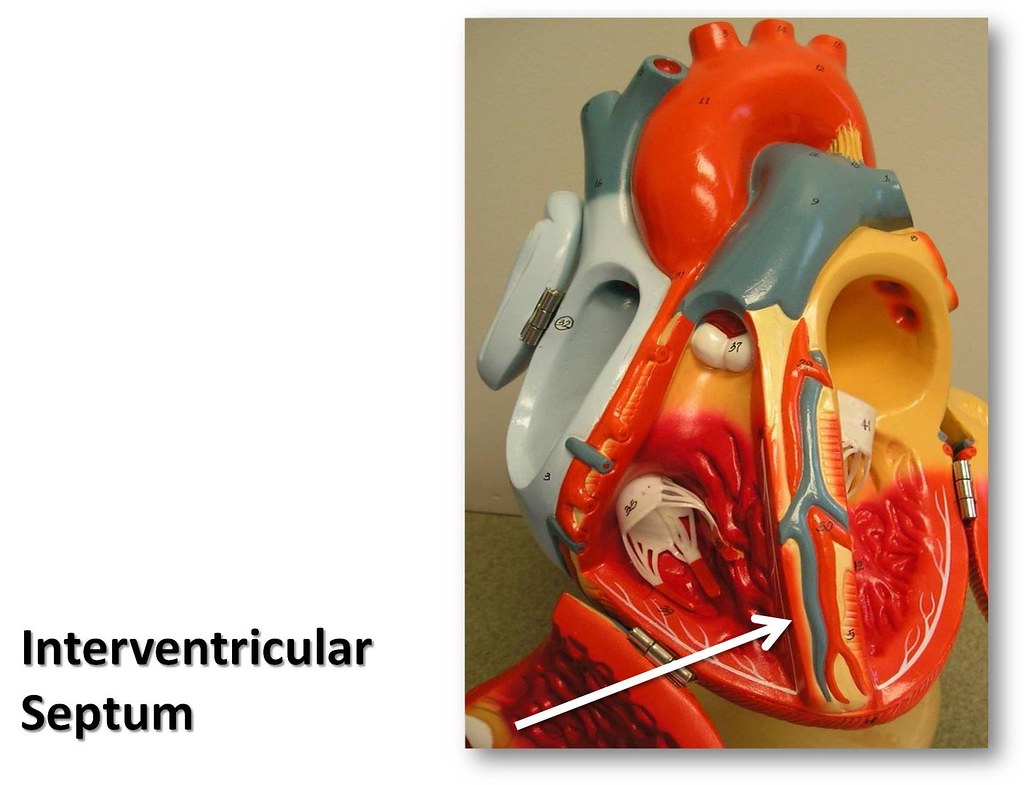 Interventricular septum - The Anatomy of the Heart Visual … | Flickr