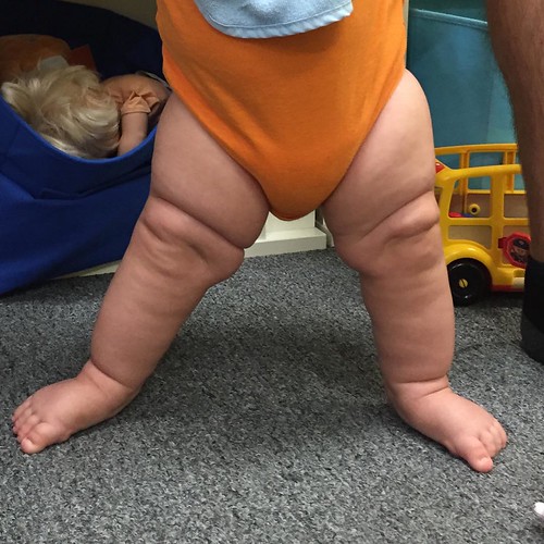 Yes!!! #babylegs #babyhood #momlife #kidsofinstagram #kidstagram #mamalife #motherhood | by mlcassid