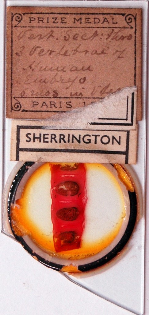 Sherrington's Box Drawer 11, Row 3, Slide 13