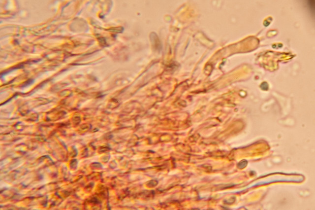 Amphinema byssoides: basidium with basidiospores