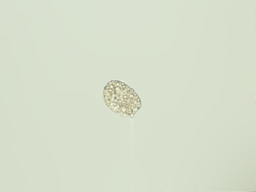 Cuerpo oval graso | Este tipo de forma se presenta en orina,… | Flickr
