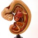 10mm Embryo Dissected