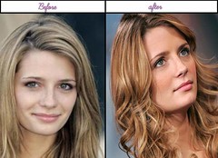 How Famous Actress Mischa Barton Been Through Plastic Surgery Her Following And Ahead Of Pictures