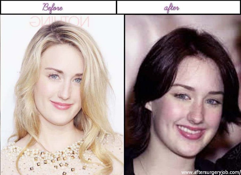 10 Amazing Plastic Surgery Pictures Of Ashley Johnson Soon…