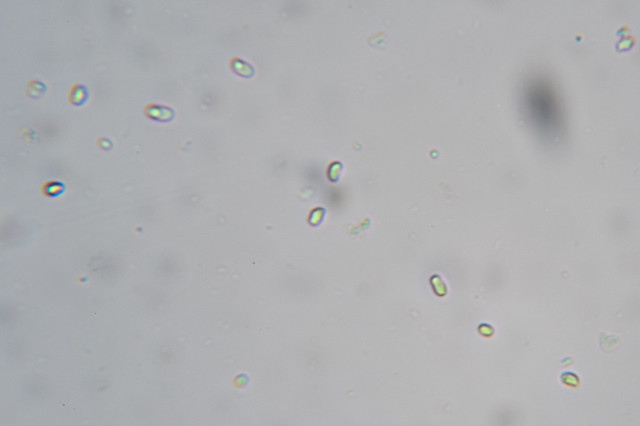 Amphinema byssoides: spores