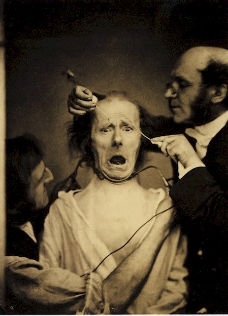Neurologist Guillaume Duchenne studying facial expressions by using electricity on a patient