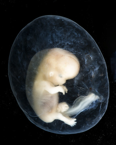 Embryo at approximately 8-10 weeks EGA from conception.