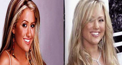 The Real Angel Faith Appears Right After And Prior To Owning Plastic Surgery