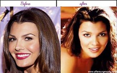 Real Life Pictures Of Ali Landry After And Before Plastic Surgery