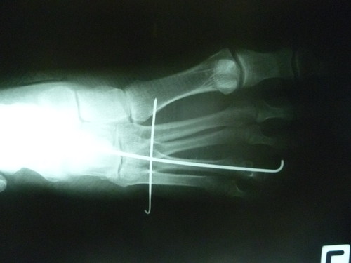 Xrays | by shelleyballenger