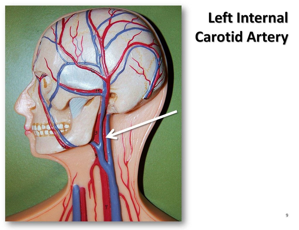 Где находится сонная артерия слева. Где находится Сонная артерия у человека. Наружная Сонная артерия анатомия. Расположение сонной артерии на шее у человека. Левая Сонная артерия кровоснабжает.