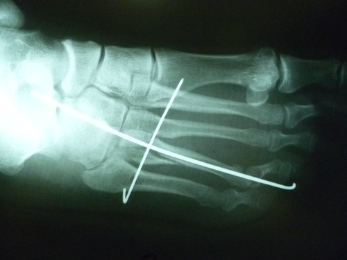 Xrays | by shelleyballenger
