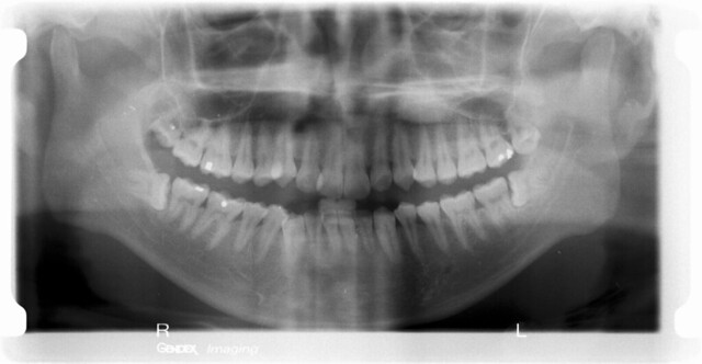 X-ray scan of my mouth