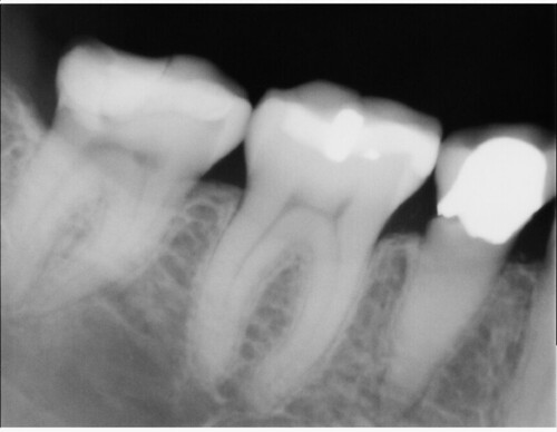 dental xray 10 | by Auntie Doe