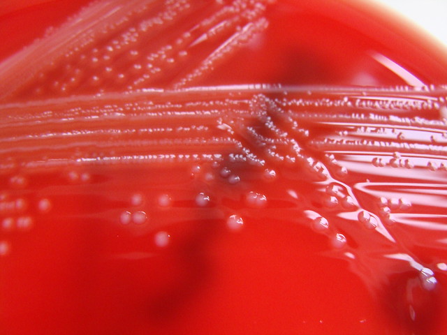 Listeria monocytogenes - Columbia Horse Blood Agar -Detail