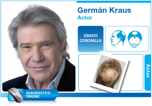 German Kraus | Actor | Medical Hair