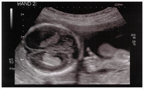 thumbsup | by Chris O'Rourke
