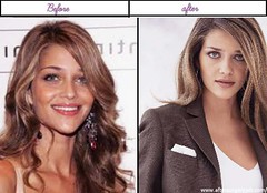 Photos of  Ana Beatriz Barros Appears To Be Like Right After Plastic Surgery 2014