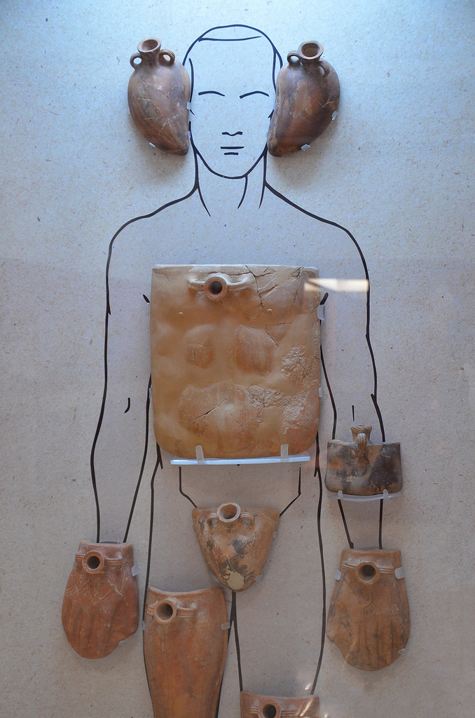 Clay hot-water bottles in the shape of human body parts for therapeutic purposes, from ancient Nea Pafos (Kato Pafos), 1st c. BC / 1st c. AD, they would have been fitted with hot liquids (water or oil), Limassol Archaeological Museum, Cyprus