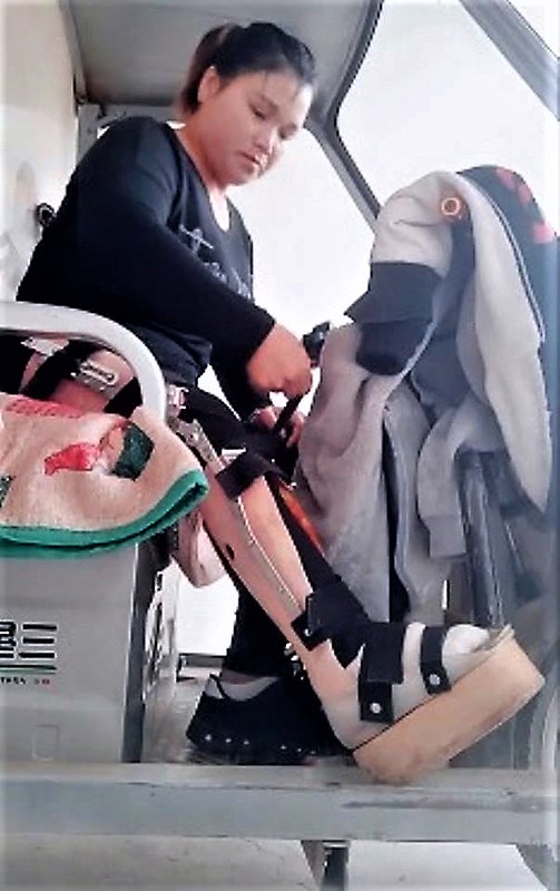 Polio Short leg 1, A polio short leg lady adjusts her hkafo…