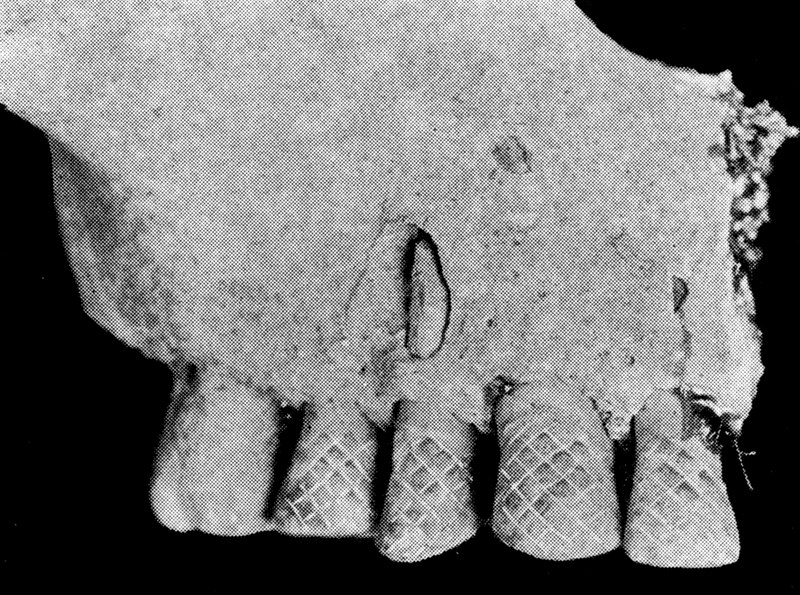 Ancient Chamorro remains of an adult female's teeth with incised designs and tooth staining.

Bishop Museum