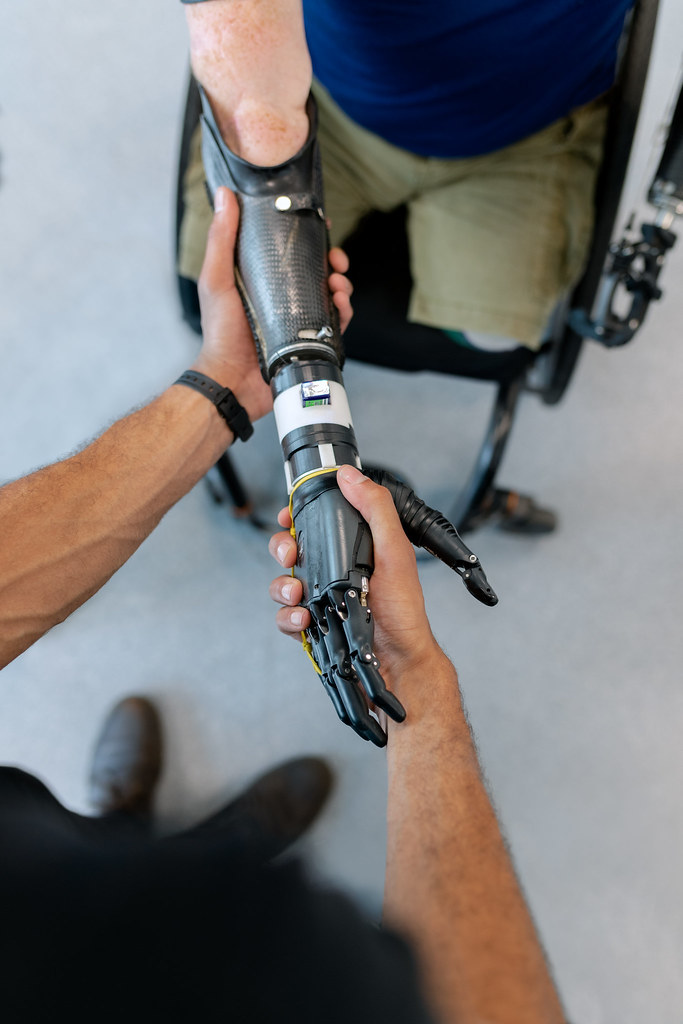 Nieuwe aankomst zand Cirkel Mechanical engineer aids with prosthetic arm | Please attrib… | Flickr