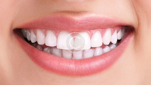 Dental Implant | by finefeatherdc