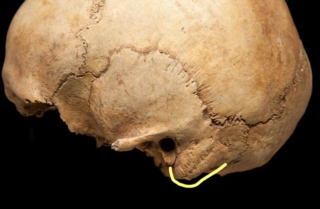 Side view of a female skull focusing in on the temporal bone