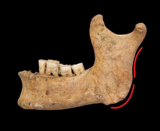 Male mandible