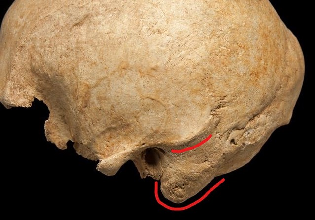 Side view of a male skull focusing in on the temporal bone