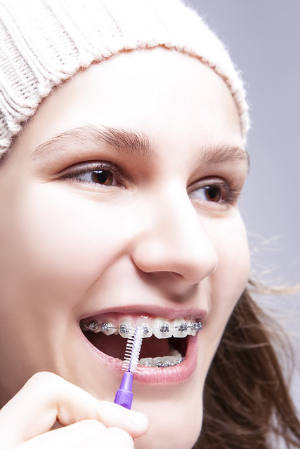 Dental Hygiene Concepts. Closeup of Teenage Girl Using Bristle Brush for Cleaning Braces and Teeth.