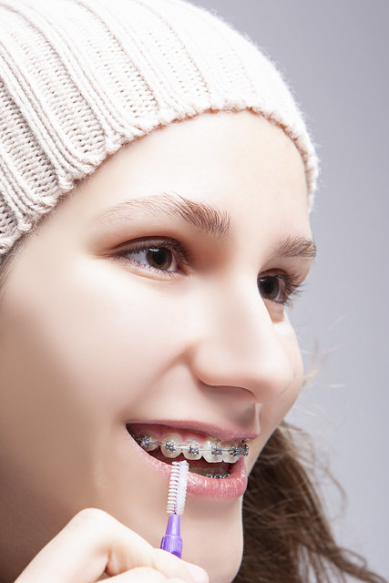 Dental Concepts. Portrait of Teenage Girl Using Bristle Brush for Cleaning Braces and Teeth