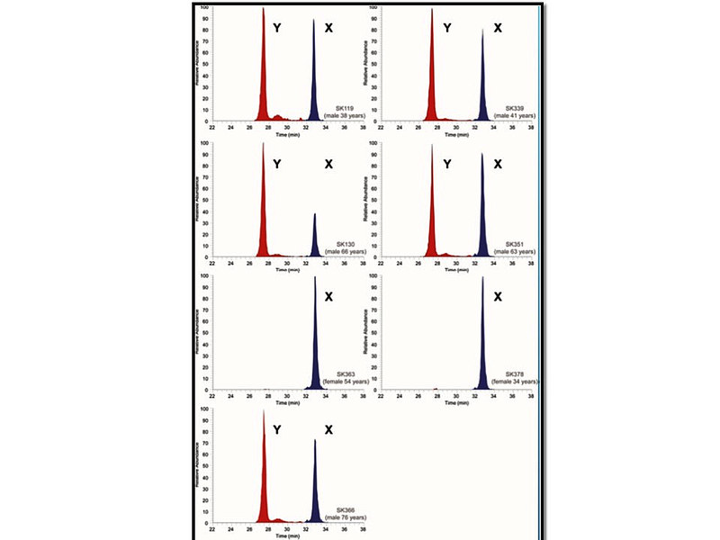 A figure showing the sexually dimorphic forms of the proteins within the tooth enamel when tested on samples of known sex. The test showed 100% accuracy