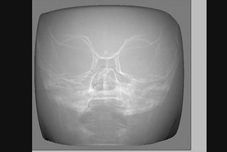 Los Alamos scientists took this image of the inside of a child’s head (it’s not a real head but an artificial representation of one) using proton radiography.