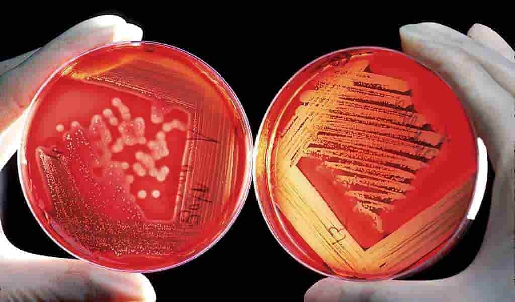 des-antibiotiques-hybrides-contre-les-biofilms