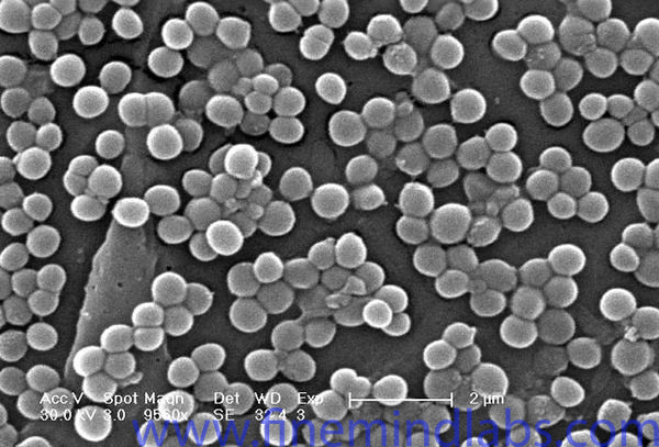 Staphylococcus aureus: Morphology, Properties, Pathogenicity, Symptoms and Treatment