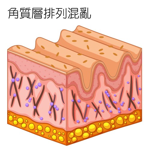 奈米拋光模式給你短短的修復期，是你要改善肌膚的好選擇，奈米拋光模式可以治療光老化、改善臉部細紋、治療淺層痘疤、修復淺層毛孔。