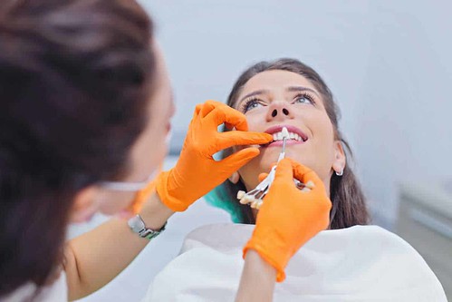dentist dentistry dentalclinic dentaloffice porcelainveneers dentalveneers