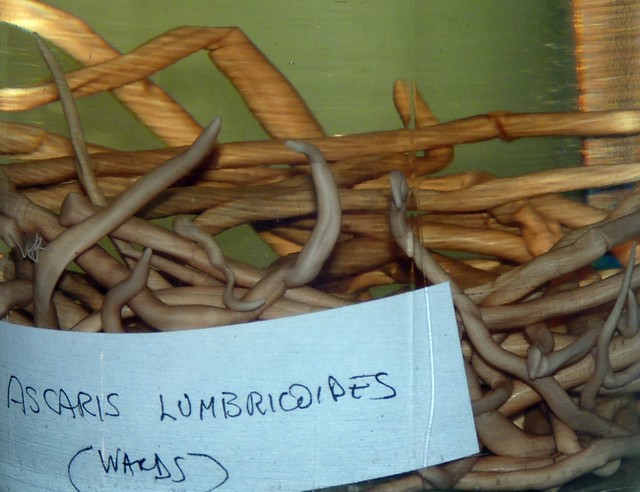 Ascaris lumbricoides (1-8-19 AMNH Biodiversity)