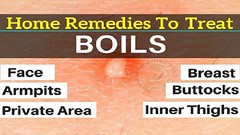 Home Remedies for Boils on Private Area